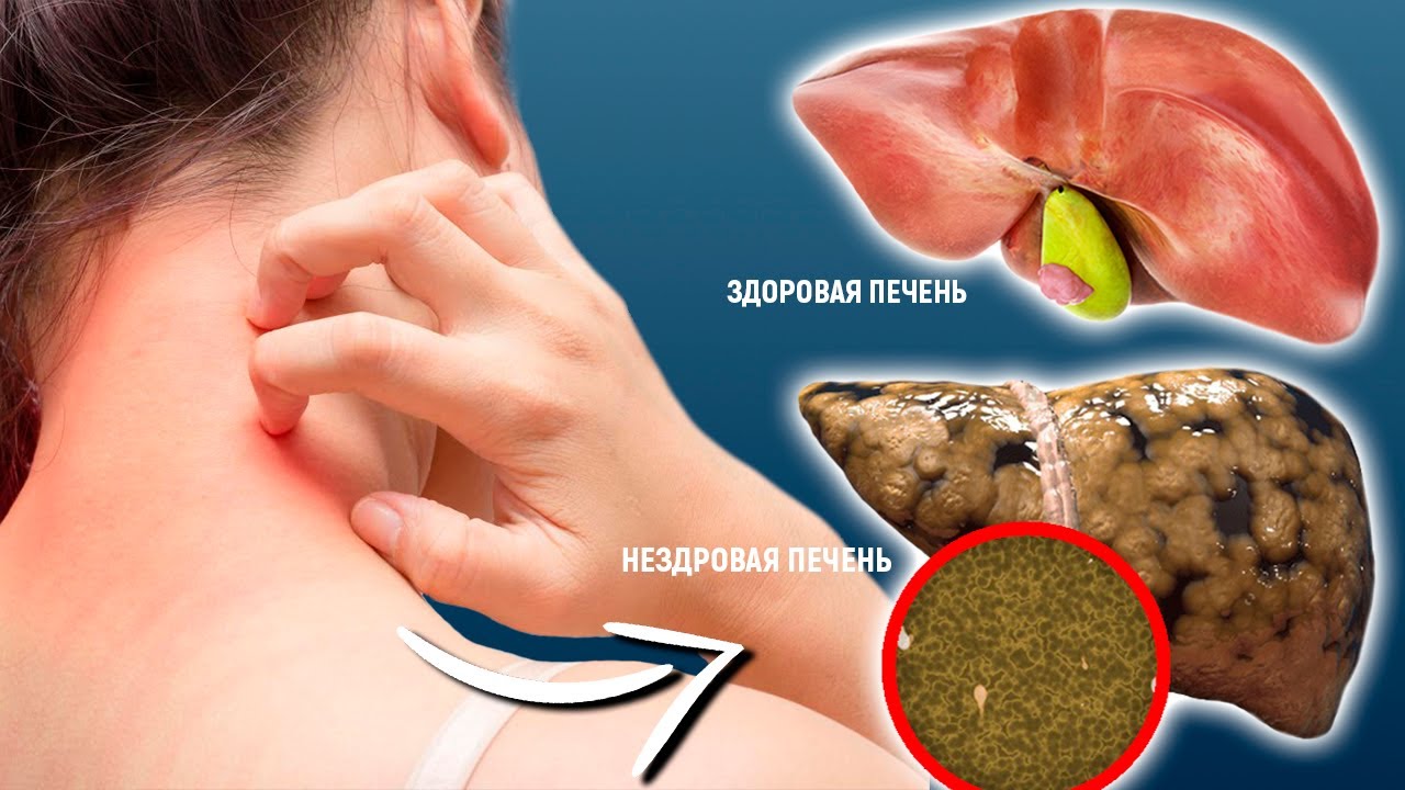 problemy s pechenyu 2